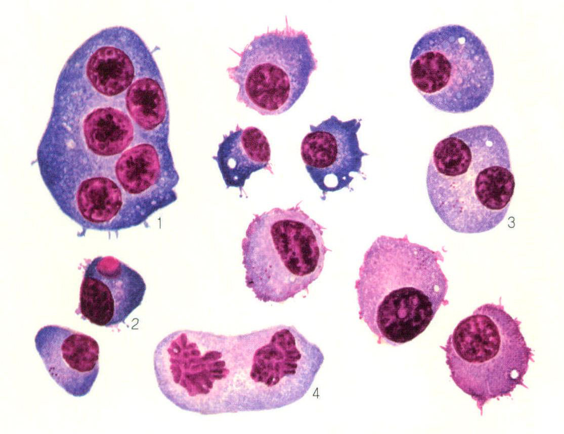 图31成熟浆细胞